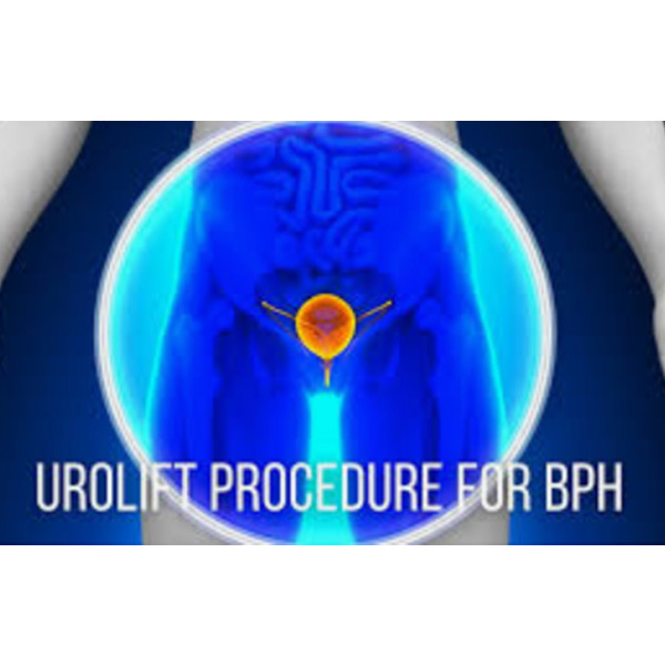 UroLift-6x6